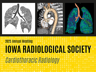 2025 Annual Meeting, Iowa Radiological Society: Cardiothoracic Radiology Banner